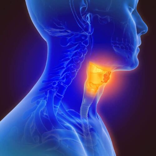 Top 5 Signs of Low Thyroid Activity, AARx in Tampa Bay and Central Florida