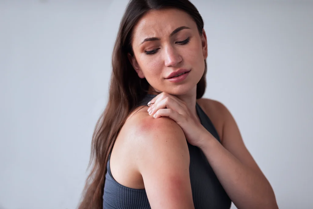 Eczema care at AARx