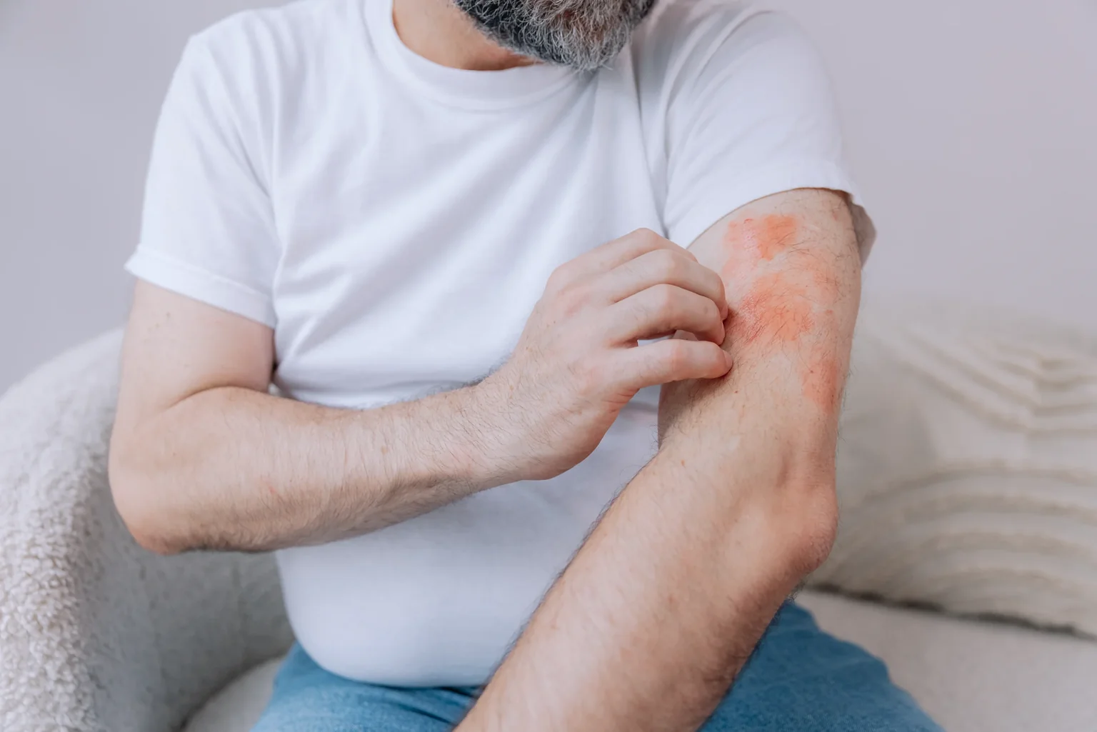Eczema care at AARx